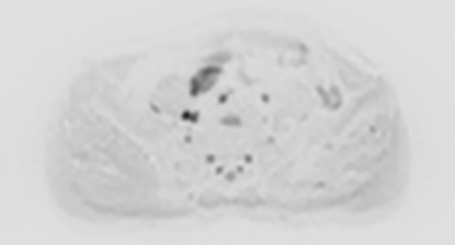 联影磁共振怎么样平原县第一人民医院联影uMR780 光梭3.0T磁共振正式投入使用，开启医学影像新时代！_https://www.jmylbn.com_新闻资讯_第20张