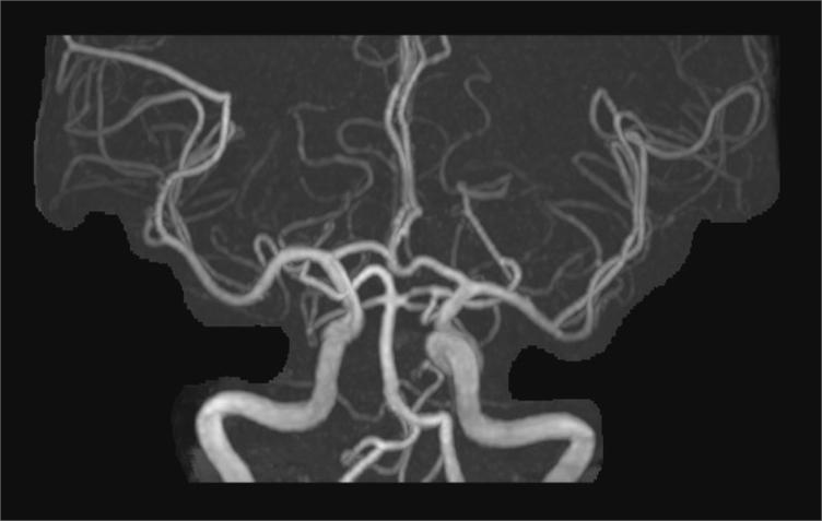 联影磁共振怎么样平原县第一人民医院联影uMR780 光梭3.0T磁共振正式投入使用，开启医学影像新时代！_https://www.jmylbn.com_新闻资讯_第5张