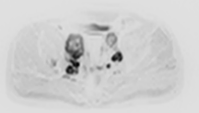 联影磁共振怎么样平原县第一人民医院联影uMR780 光梭3.0T磁共振正式投入使用，开启医学影像新时代！_https://www.jmylbn.com_新闻资讯_第21张