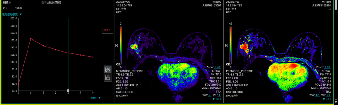 联影磁共振怎么样平原县第一人民医院联影uMR780 光梭3.0T磁共振正式投入使用，开启医学影像新时代！_https://www.jmylbn.com_新闻资讯_第11张