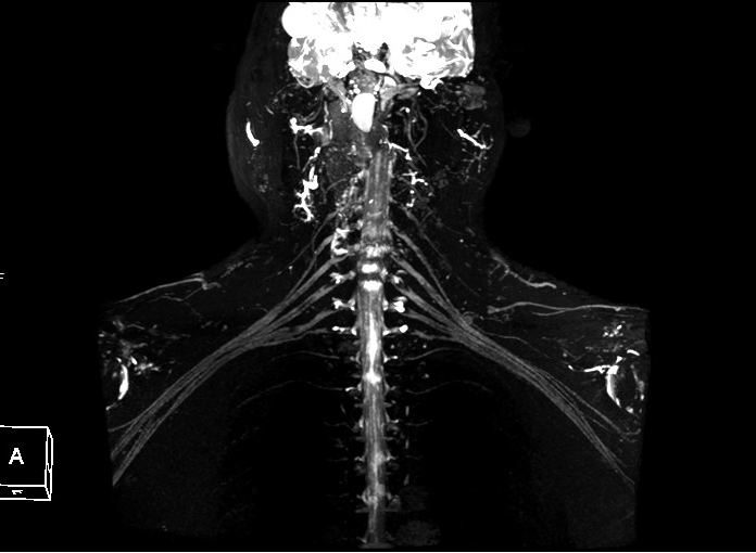 联影磁共振怎么样平原县第一人民医院联影uMR780 光梭3.0T磁共振正式投入使用，开启医学影像新时代！_https://www.jmylbn.com_新闻资讯_第24张