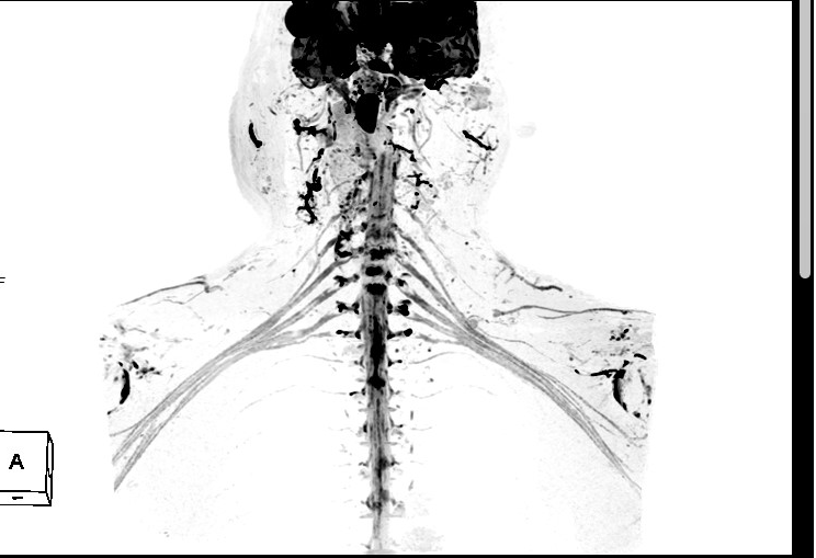 联影磁共振怎么样平原县第一人民医院联影uMR780 光梭3.0T磁共振正式投入使用，开启医学影像新时代！_https://www.jmylbn.com_新闻资讯_第25张