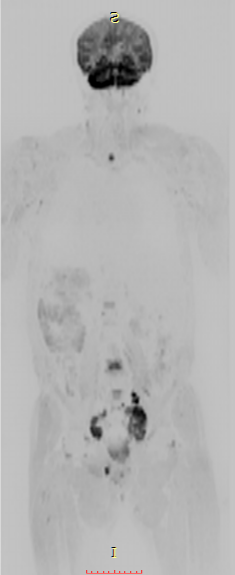 联影磁共振怎么样平原县第一人民医院联影uMR780 光梭3.0T磁共振正式投入使用，开启医学影像新时代！_https://www.jmylbn.com_新闻资讯_第19张
