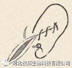 手术工具怎么消毒外科基本手术_https://www.jmylbn.com_新闻资讯_第27张