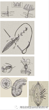 手术工具怎么消毒外科基本手术_https://www.jmylbn.com_新闻资讯_第28张