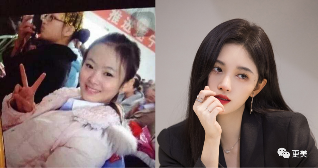 【整容】四千年美女鞠婧祎疑似连头皮都整了？！网友吐槽：是个狠人（组图） - 9