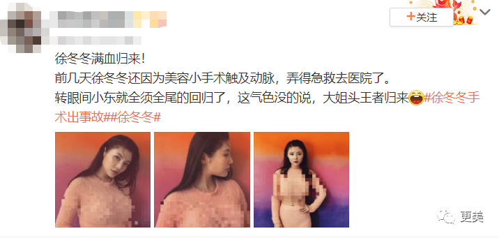 内衣广告照片被狂打码，杨幂热巴正在被逼成下一个柳岩...（组图） - 38