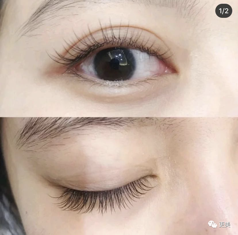 【整容】四千年美女鞠婧祎疑似连头皮都整了？！网友吐槽：是个狠人（组图） - 58