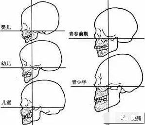 她是花千骨里最醜童星，臉比楊冪還方，現在逆襲下頜角神奇消失 戲劇 第26張