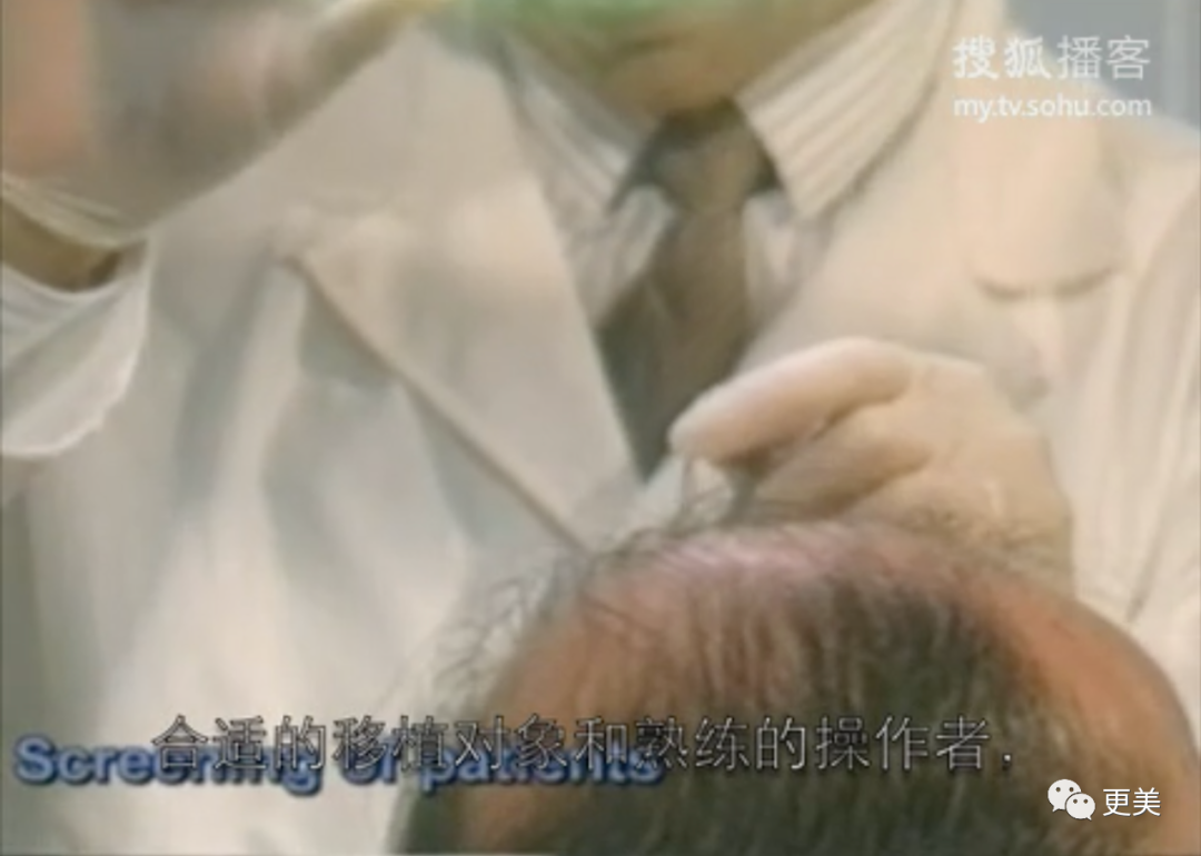 【整容】四千年美女鞠婧祎疑似连头皮都整了？！网友吐槽：是个狠人（组图） - 25