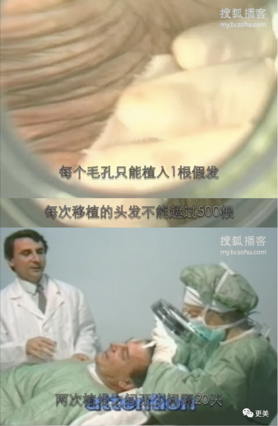 【整容】四千年美女鞠婧祎疑似连头皮都整了？！网友吐槽：是个狠人（组图） - 28