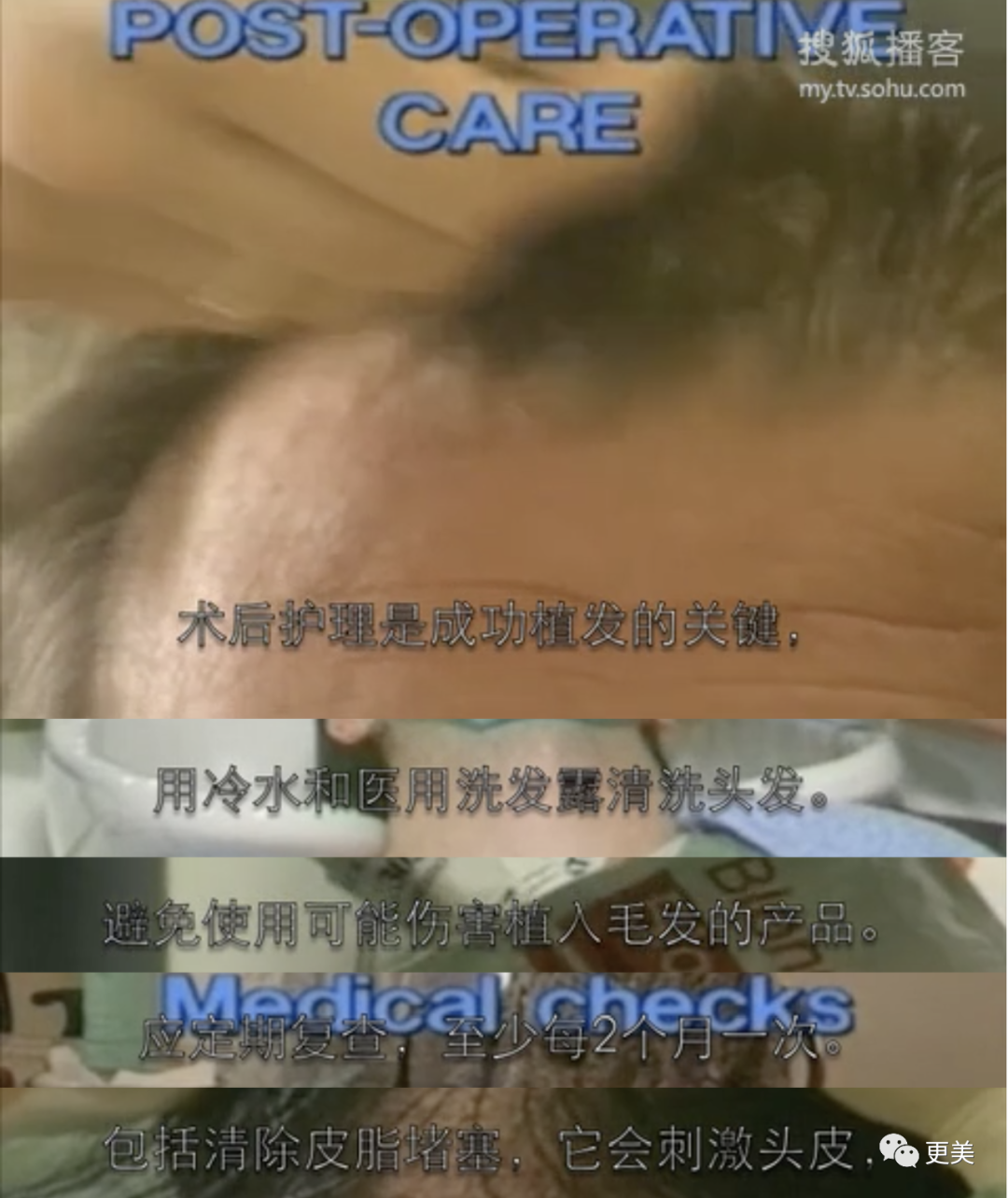 【整容】四千年美女鞠婧祎疑似连头皮都整了？！网友吐槽：是个狠人（组图） - 30