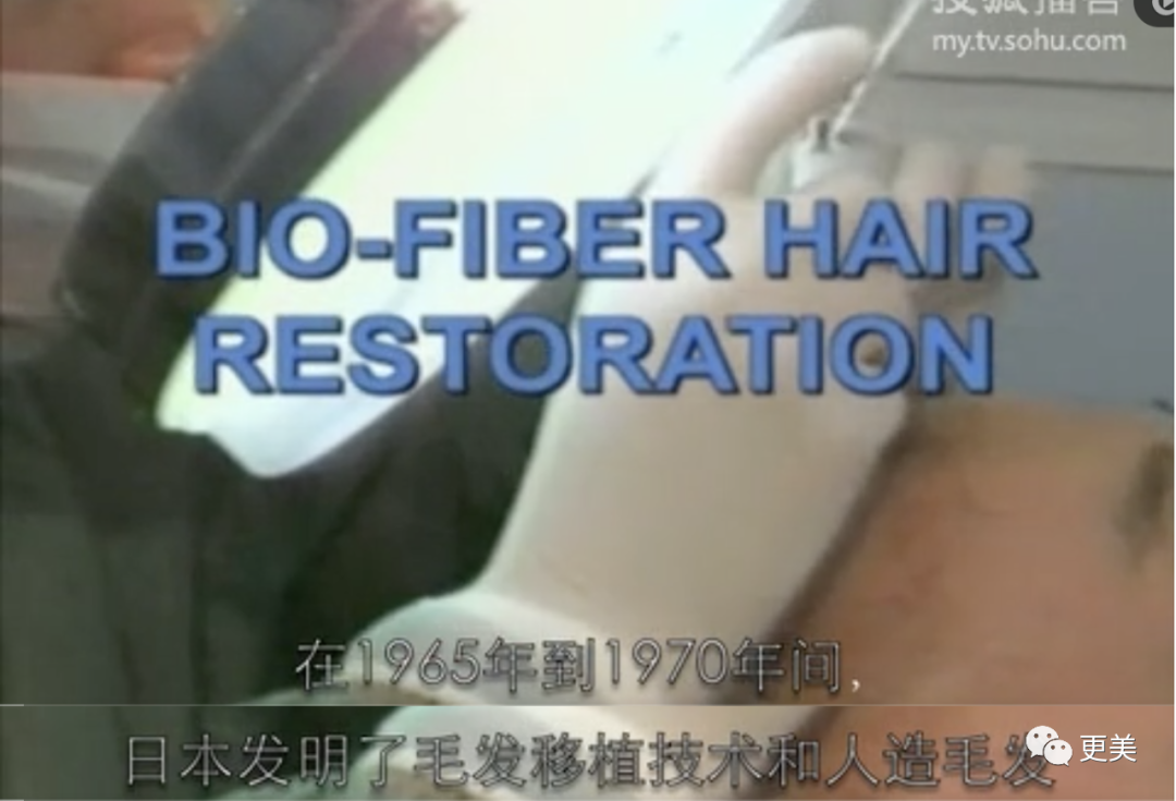 【整容】四千年美女鞠婧祎疑似连头皮都整了？！网友吐槽：是个狠人（组图） - 22