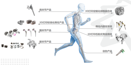 腰椎融合器材有哪些技术分析 ｜ 金属增材制造胸腰椎融合匹配式假体系统 【骨科创新医械】_https://www.jmylbn.com_新闻资讯_第4张