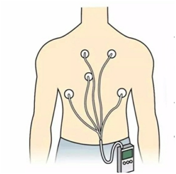 十二道心电图怎么检查儿童心电图检查，需要注意些什么_https://www.jmylbn.com_新闻资讯_第1张