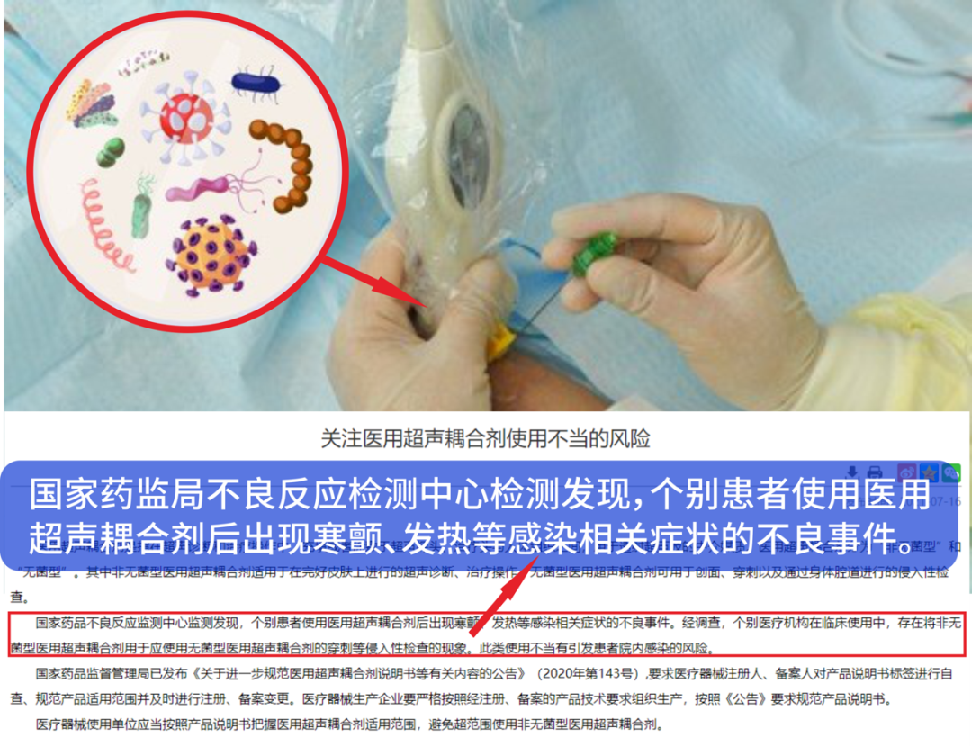 杀菌型耦合剂是什么为什么需要用无菌耦合剂？_https://www.jmylbn.com_新闻资讯_第3张