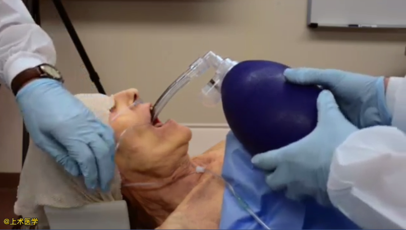 为什么要用喉罩围术杂谈丨喉罩使用方法大全！_https://www.jmylbn.com_新闻资讯_第6张