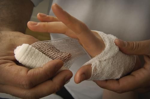 疤痕那些事（2）影响伤口留疤的因素有哪些？ 