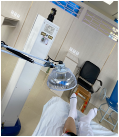 康复治疗激光怎么收费【康复治疗】物理因子之光—氦氖激光_https://www.jmylbn.com_新闻资讯_第4张