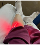 康复治疗激光怎么收费【康复治疗】物理因子之光—氦氖激光_https://www.jmylbn.com_新闻资讯_第6张