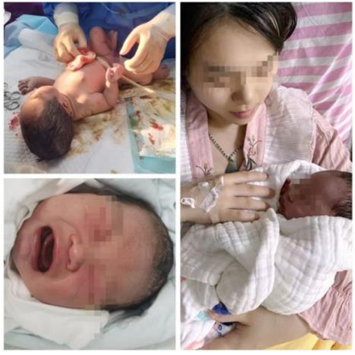 子宫颈扩张球囊是什么宫颈扩张球囊，顺产妈妈的福音_https://www.jmylbn.com_新闻资讯_第3张