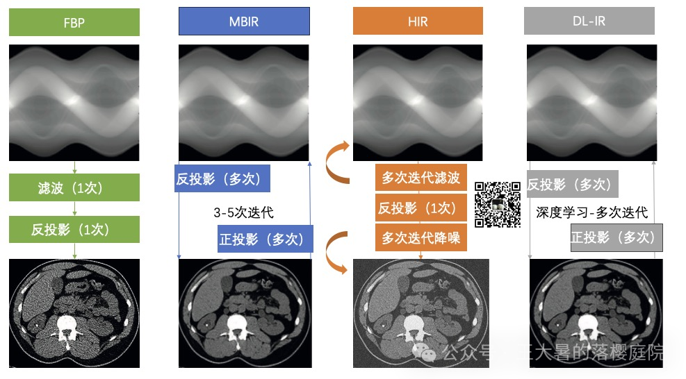 #105 CT重建的3D深度学习技术——迭代算法详解