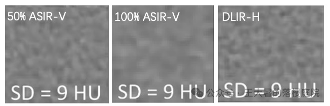 #105 CT重建的3D深度学习技术——迭代算法详解