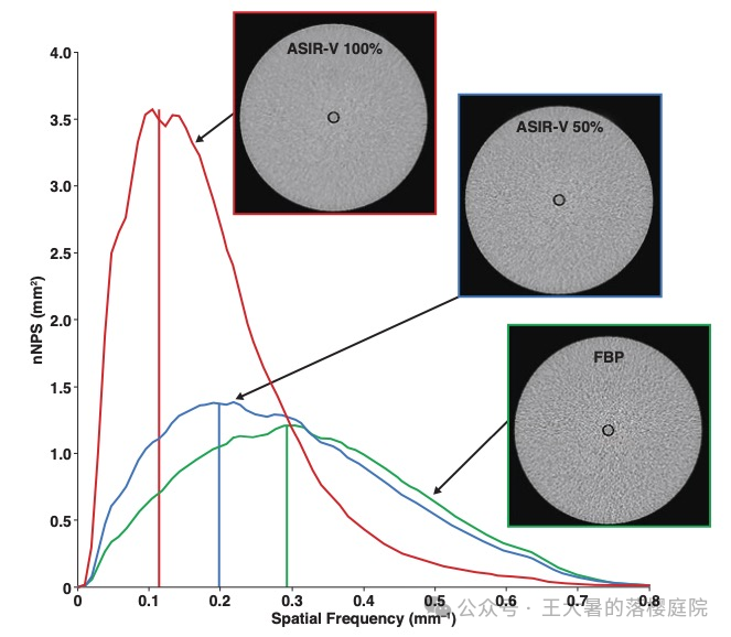 #105 CT重建的3D深度学习技术——迭代算法详解