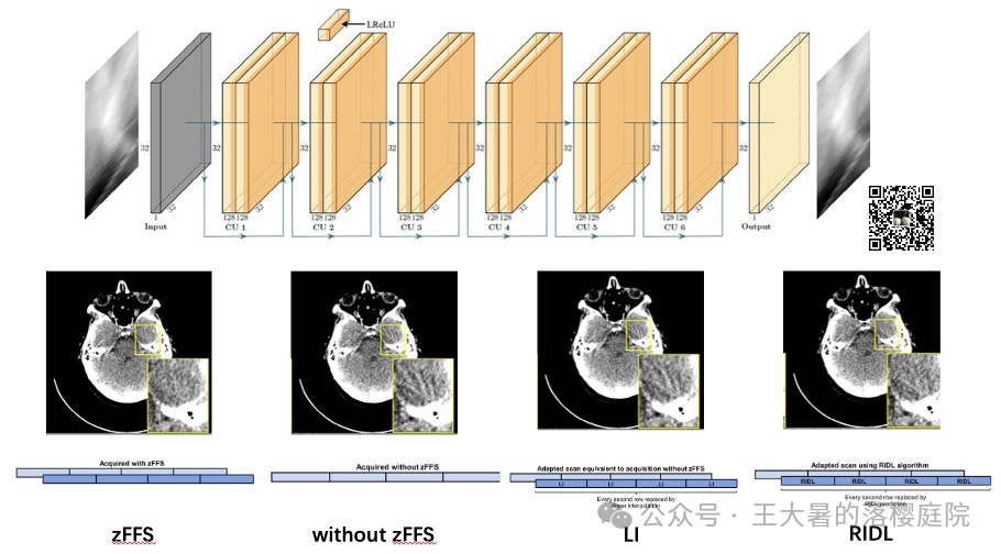 #108 CT重建的3D深度学习技术——深度学习图像重建算法分类2