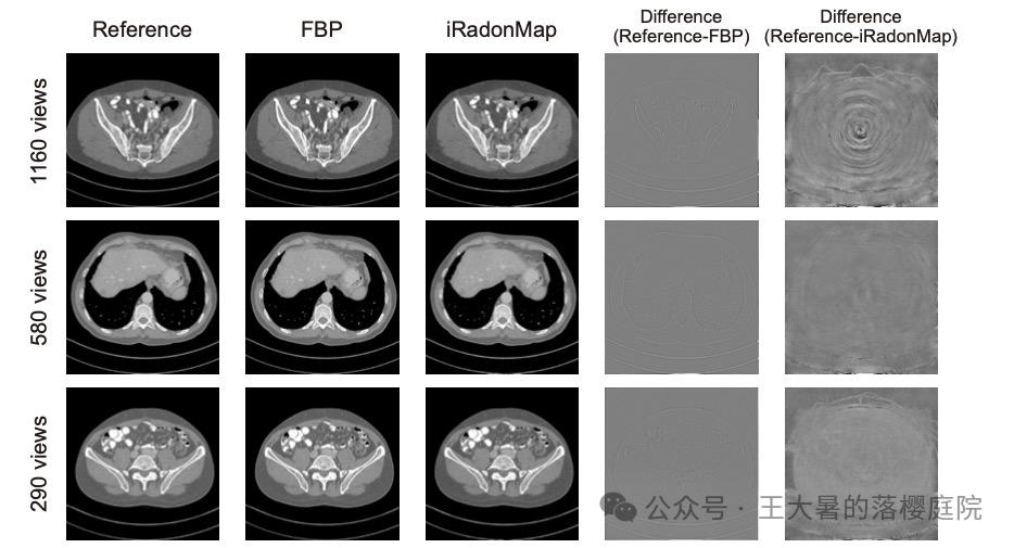 #108 CT重建的3D深度学习技术——深度学习图像重建算法分类2