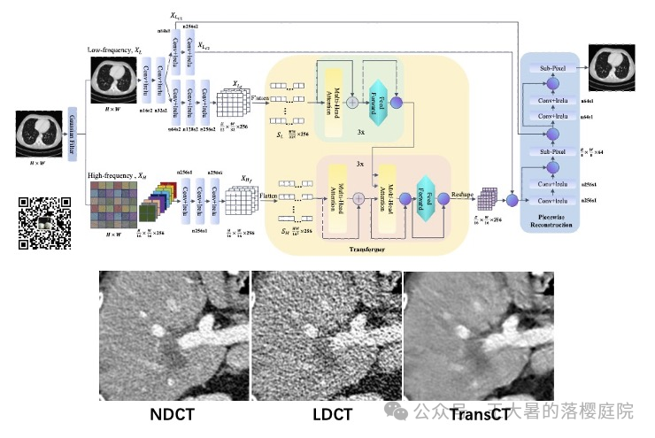 #108 CT重建的3D深度学习技术——深度学习图像重建算法分类2