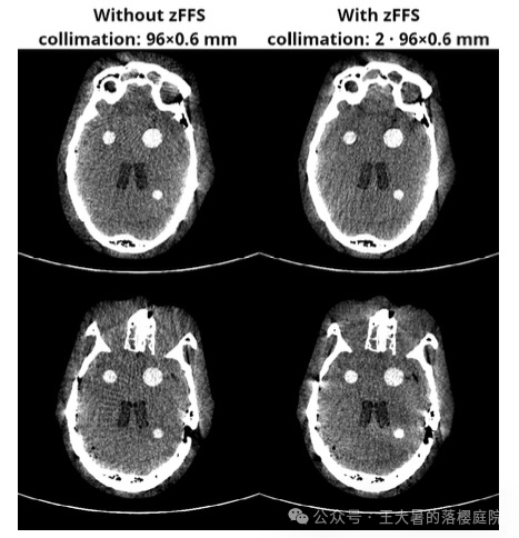 #108 CT重建的3D深度学习技术——深度学习图像重建算法分类2
