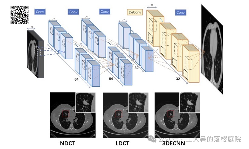 #108 CT重建的3D深度学习技术——深度学习图像重建算法分类2