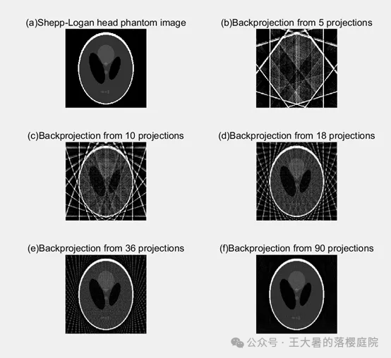 #108 CT重建的3D深度学习技术——深度学习图像重建算法分类2