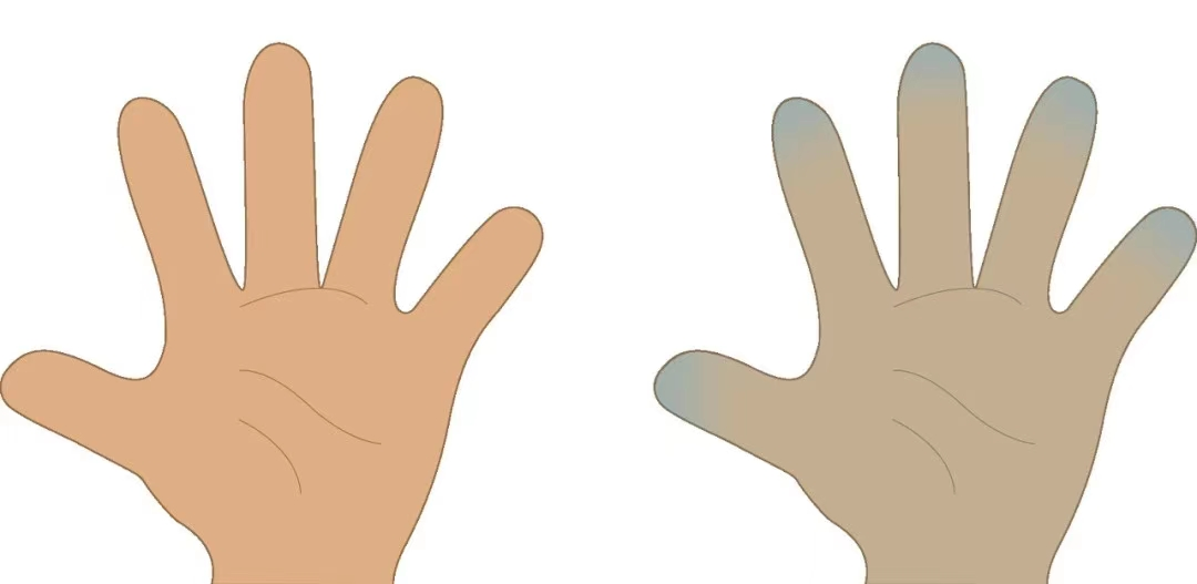 氧饱仪怎么用健康港湾｜“氧”生之道知多少？您必须知道的居家氧疗小常识_https://www.jmylbn.com_新闻资讯_第18张