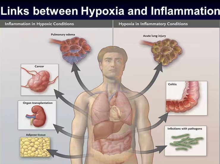 氧饱仪怎么用健康港湾｜“氧”生之道知多少？您必须知道的居家氧疗小常识_https://www.jmylbn.com_新闻资讯_第39张