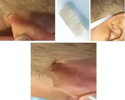 氧饱仪怎么用健康港湾｜“氧”生之道知多少？您必须知道的居家氧疗小常识_https://www.jmylbn.com_新闻资讯_第76张