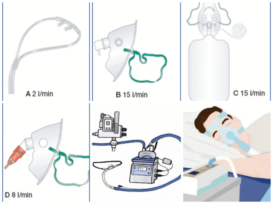 氧饱仪怎么用健康港湾｜“氧”生之道知多少？您必须知道的居家氧疗小常识_https://www.jmylbn.com_新闻资讯_第25张