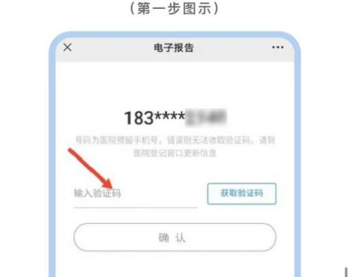 怎么自助取胶片医院市一院“云胶片”让影像报告获取更便捷_https://www.jmylbn.com_新闻资讯_第7张