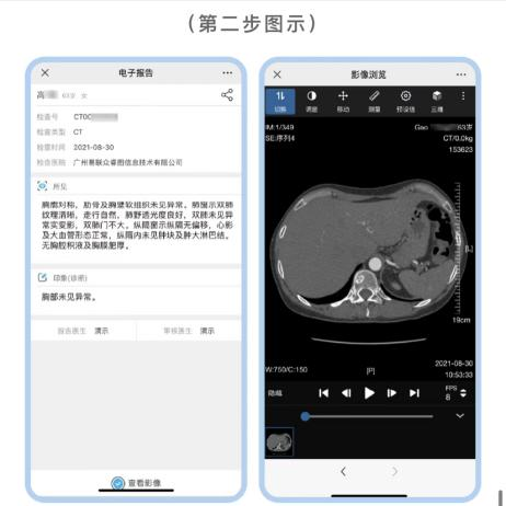 怎么自助取胶片医院市一院“云胶片”让影像报告获取更便捷_https://www.jmylbn.com_新闻资讯_第8张