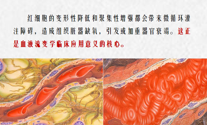 血流变是什么颜色的管血流变项目对心脑血管疾病的重要意义_https://www.jmylbn.com_新闻资讯_第4张