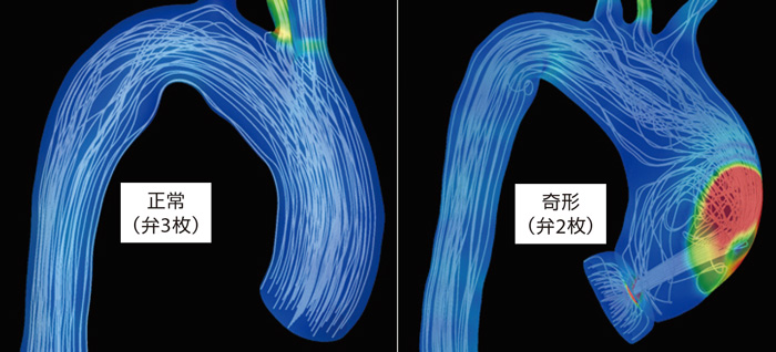 案例分析 | 从工程学角度预测血管和气管的流量并研究生物的图4