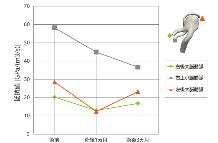 案例分析 | 从工程学角度预测血管和气管的流量并研究生物的图6