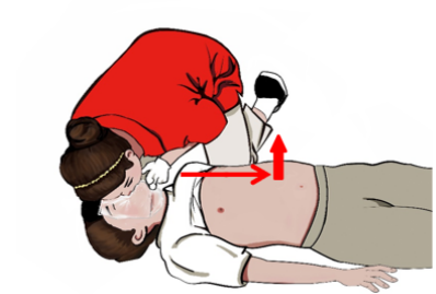 cpr按压板怎么用【健康知识宣传】关键时刻能救命！说一说心肺复苏急救法_https://www.jmylbn.com_新闻资讯_第10张