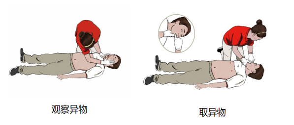 cpr按压板怎么用【健康知识宣传】关键时刻能救命！说一说心肺复苏急救法_https://www.jmylbn.com_新闻资讯_第9张