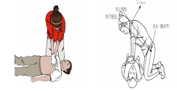cpr按压板怎么用【健康知识宣传】关键时刻能救命！说一说心肺复苏急救法_https://www.jmylbn.com_新闻资讯_第7张