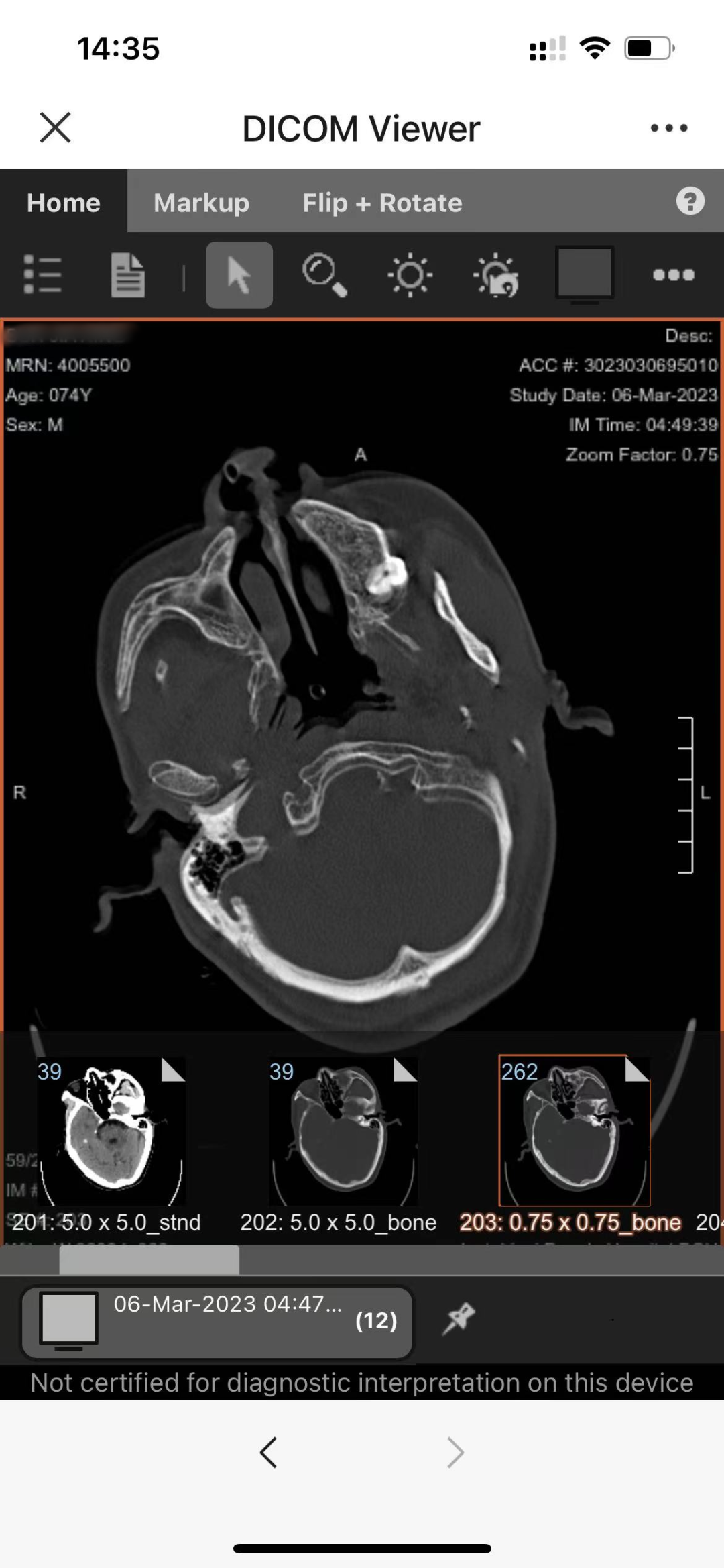 打印胶片是什么告别“胶片”时代  手机扫码查看“云胶片”_https://www.jmylbn.com_新闻资讯_第9张