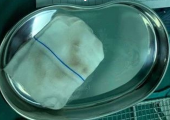 手术工具怎么消毒手术器械拿下去，消毒供应中心为什么不给灭菌？_https://www.jmylbn.com_新闻资讯_第7张