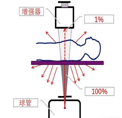 c臂机怎么上升C臂机透视中，防护的那些事！_https://www.jmylbn.com_新闻资讯_第6张