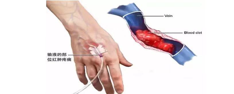 为什么微量泵会响微量泵报警，我们该如何处理？？_https://www.jmylbn.com_新闻资讯_第4张